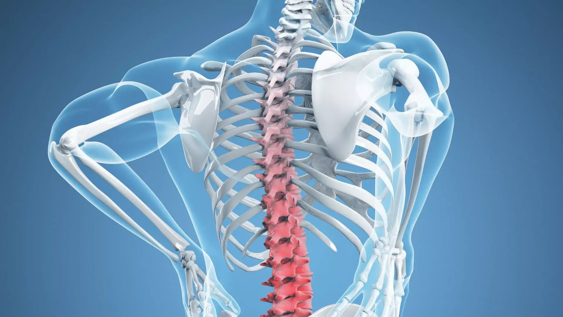 arthritis back pain